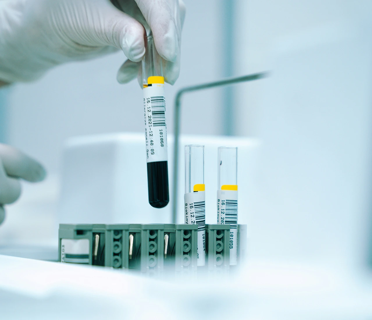 臨床研究で使用される血液サンプルの入った試験管